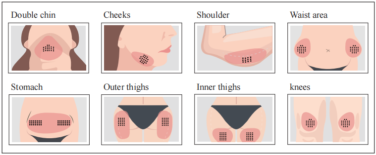 AOMA Fat Dissolving solution Injection AOMA溶脂液注射液