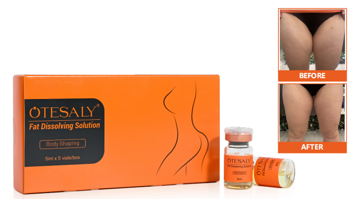 AOMA Fat Dissolving Solution AOMA溶脂液