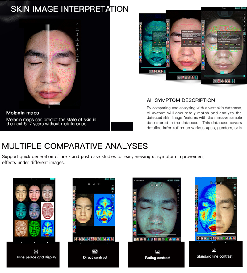 Analizador de piel, máquina analizadora de piel, máquina analizadora de piel facial, analizador de piel 3d, analizador de piel AI, analizador de piel facial, analizador de piel móvil, analizador de piel con lámpara de madera, analizador de piel con escáner facial, analizador de piel con escáner facial