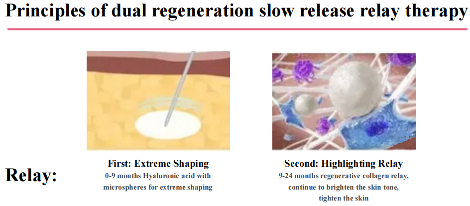 How PLLA Filler Works PLLA 填充剂的工作原理