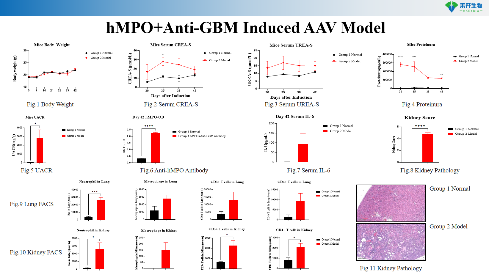 hMPO+Anti-GBM Induced AAV Model d5094ca1ce734aff80a3d453740e8e56