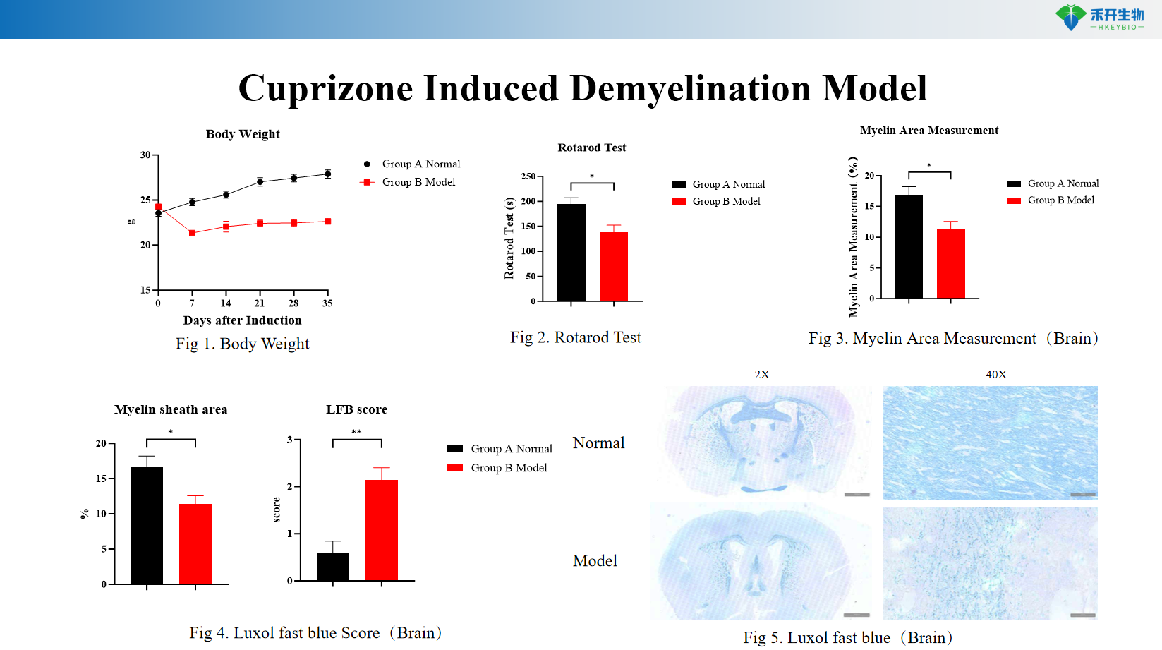 Cuprizone Induced Demyelination Model 3fb93a8040c095473c820d017582a333