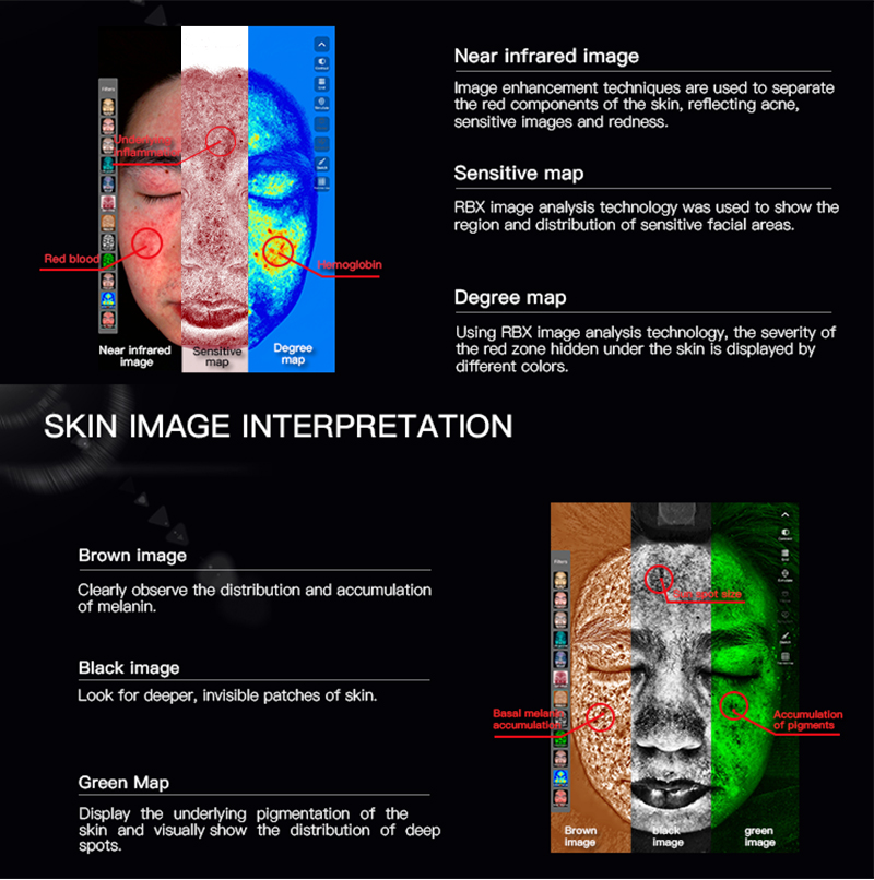 Analizador de piel, máquina analizadora de piel, máquina analizadora de piel facial, analizador de piel 3d, analizador de piel AI, analizador de piel facial, analizador de piel móvil, analizador de piel con lámpara de madera, analizador de piel con escáner facial, analizador de piel con escáner facial