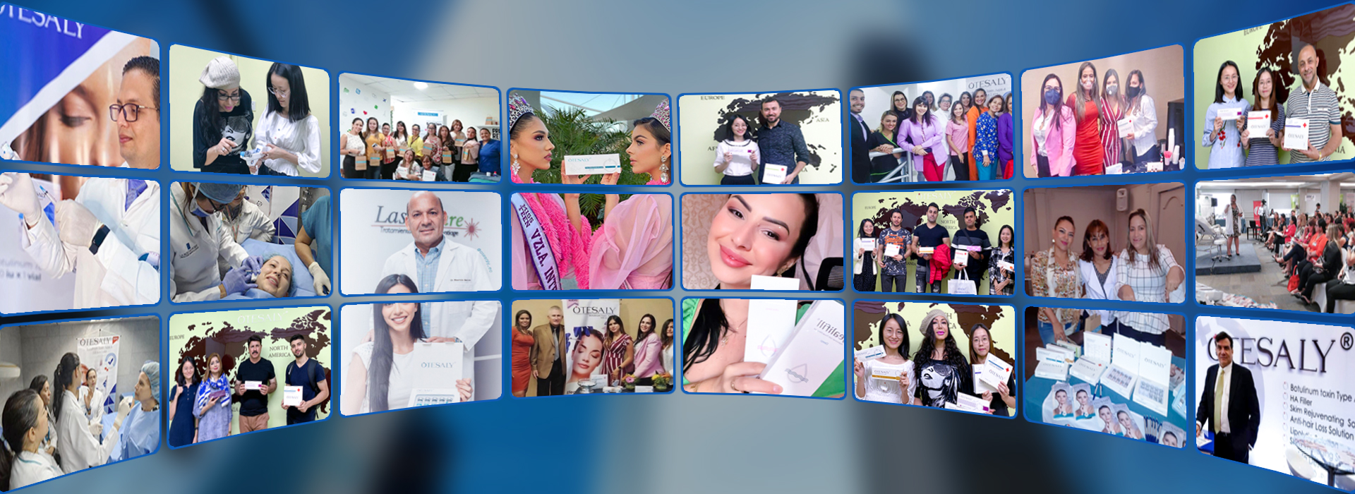 Before and After dermal filler AOMA AOMA 真皮填充剂前后对比