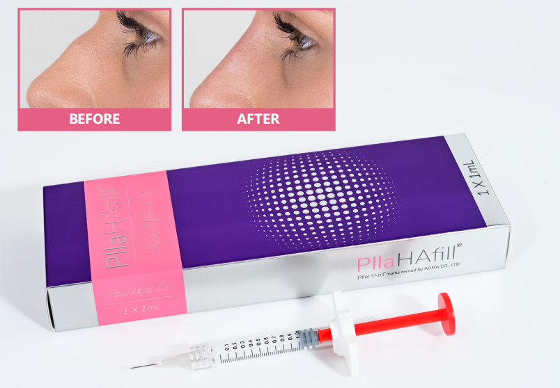 AOMA PllaHAfill LD AOMA PlaHAfill LD