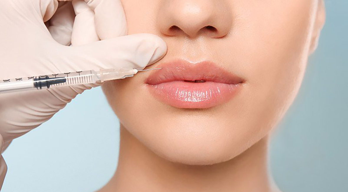 图片 1 丰唇玻尿酸真皮填充剂