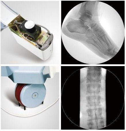 Equipo médico de fábrica de China de rayos X de alta frecuencia de brazo en C móvil