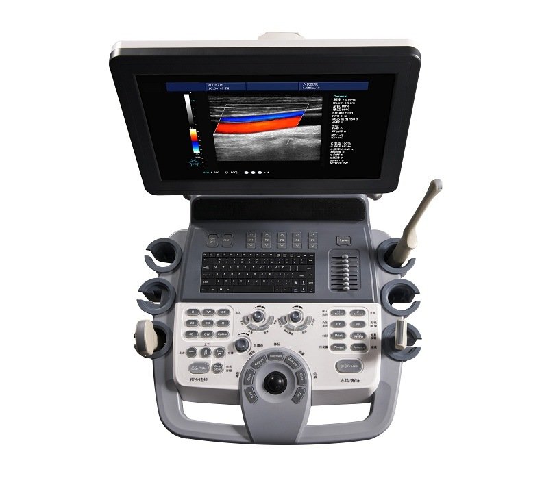 Sistema de diagnóstico médico HUC-800 Escáner de ultrasonido Doppler a color con carro digital completo 4D