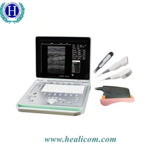 HV-7 Fill Digital B Mode portatile portatile medico veterinario ad ultrasuoni scanner diagnostico veterinario macchina ad ultrasuoni