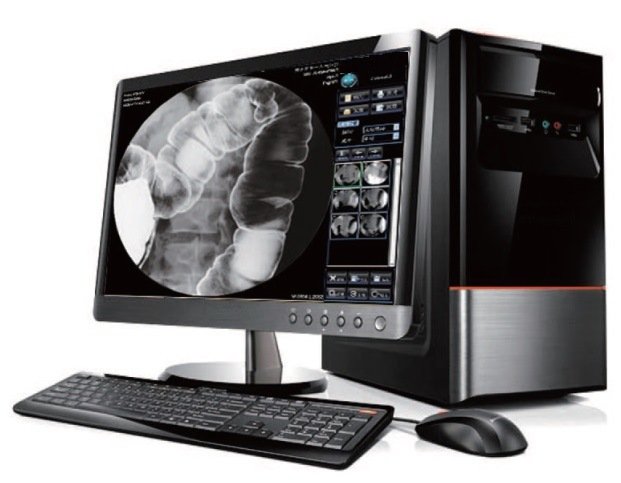 Equipo de rayos X digitales de alta frecuencia HDF-6000