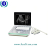 HBW-7 S/W Laptop-Ultraschall-Scanner Tragbares Ultraschall-Diagnosesystem