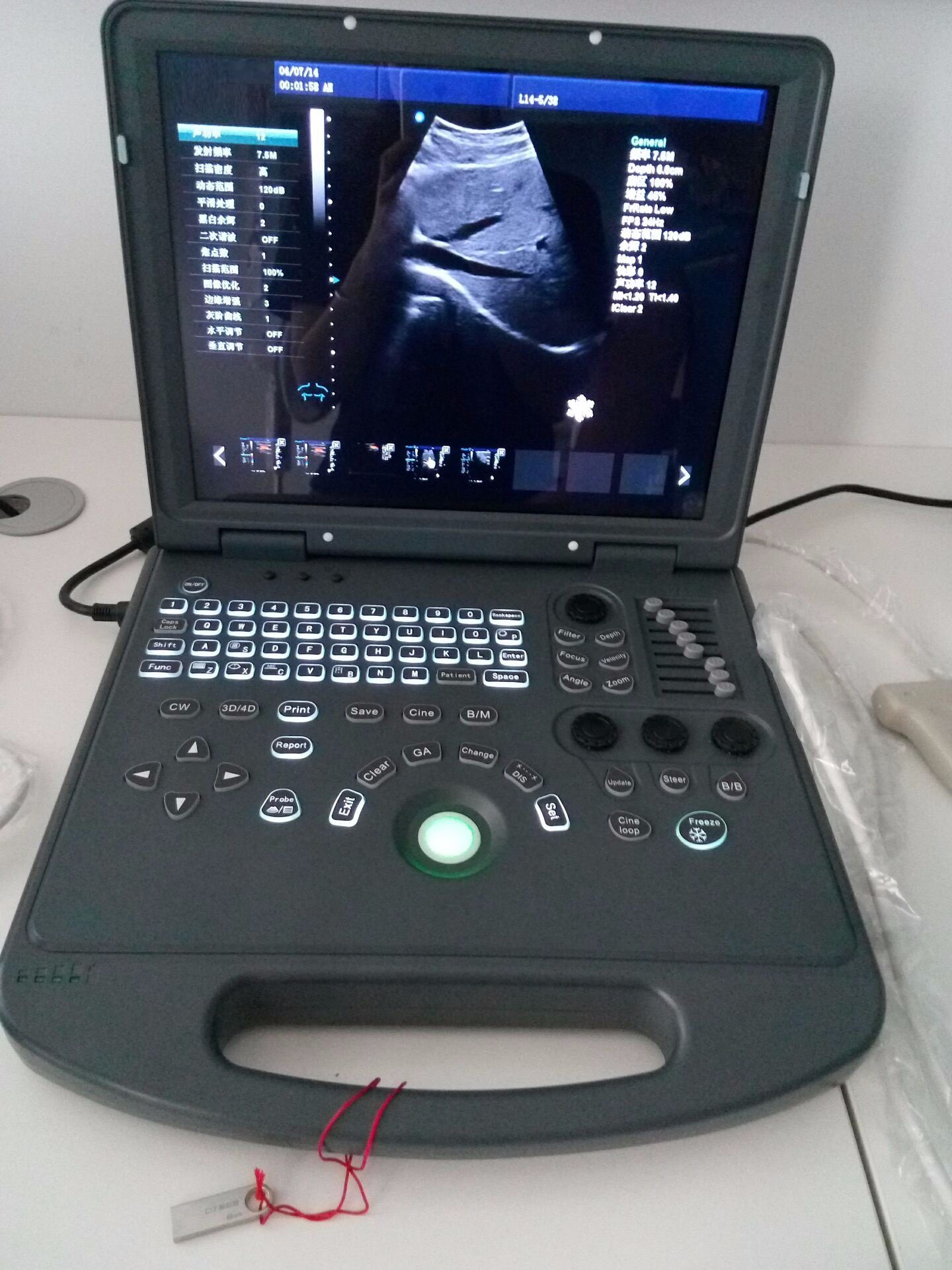 Escáner de ultrasonido Doppler color portátil 2D portátil de precio barato HUC-200