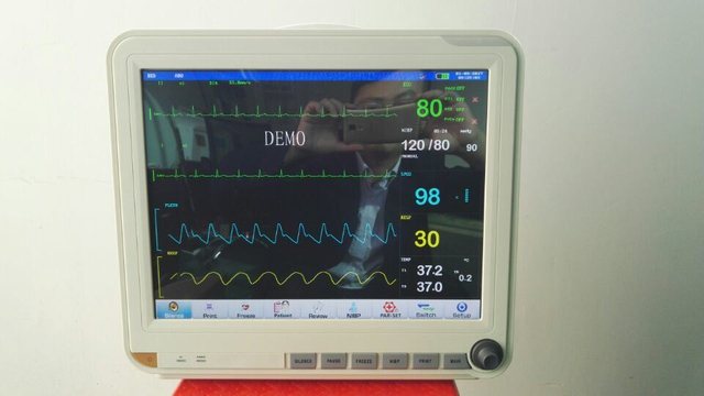 HM-2000E Medizinische Geräte 15 Zoll tragbarer EKG-Multiparameter-Patientenmonitor