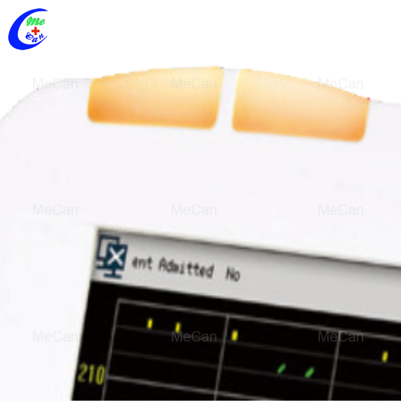 Fetal Maternal Monitor MCS0060 (6)