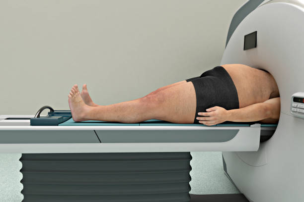 Ndị ọrịa buru ibu na-enwe arụmọrụ onyonyo ka njọ na Open MRI