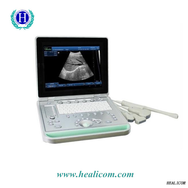 Heißer Verkauf HBW-9 Laptop-Diagnosesystem Tragbares 3D-Ultraschallgerät S / W-Ultraschall