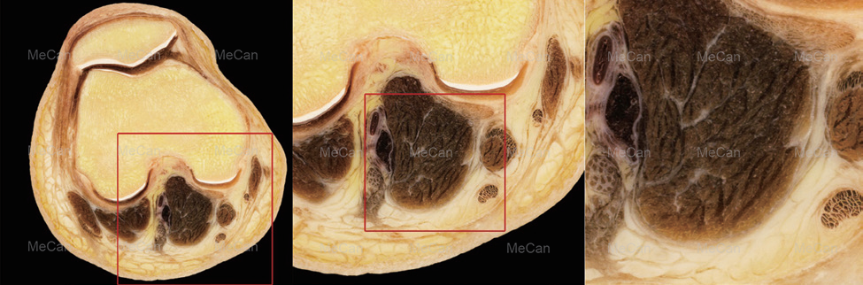 1.Virtual Anatomy Table-SD ຂໍ້ມູນແລະການສະແດງລະມັດລະວັງ