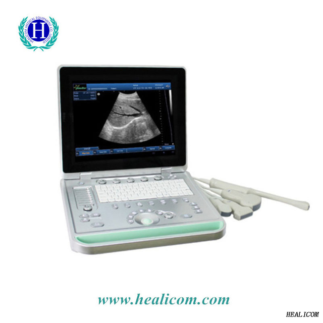 HV-9 Full Digital S/W Handheld Handheld Veterinär-Ultraschall-Scanner Tragbarer Tierarzt-Ultraschall