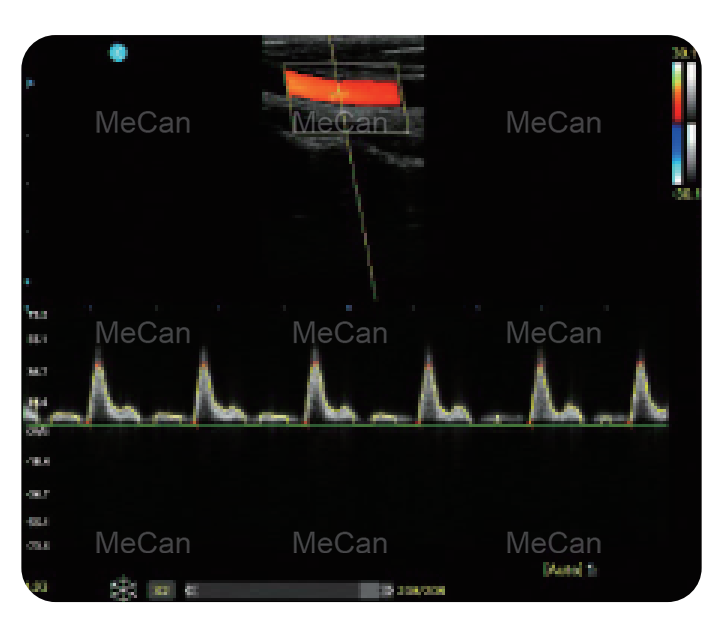 MeCan MCI0512 Portable Color Doppler Ultrasound kinerja banget
