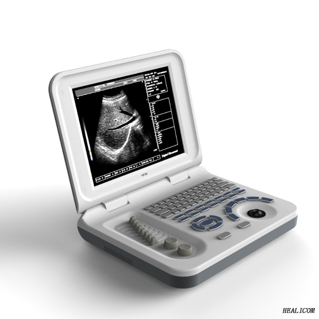 Heißer Verkauf HBW-3 Diagnosegeräte Tragbare 3D-Ultraschall-Scanner-Maschine