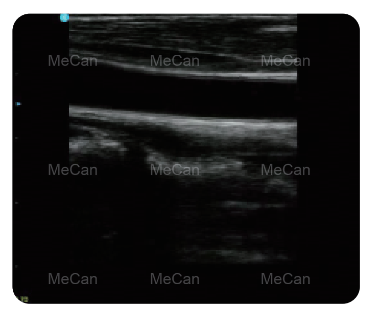 MeCan MCI0512 Portable Color Doppler Ultrasound kinerja apik banget 3