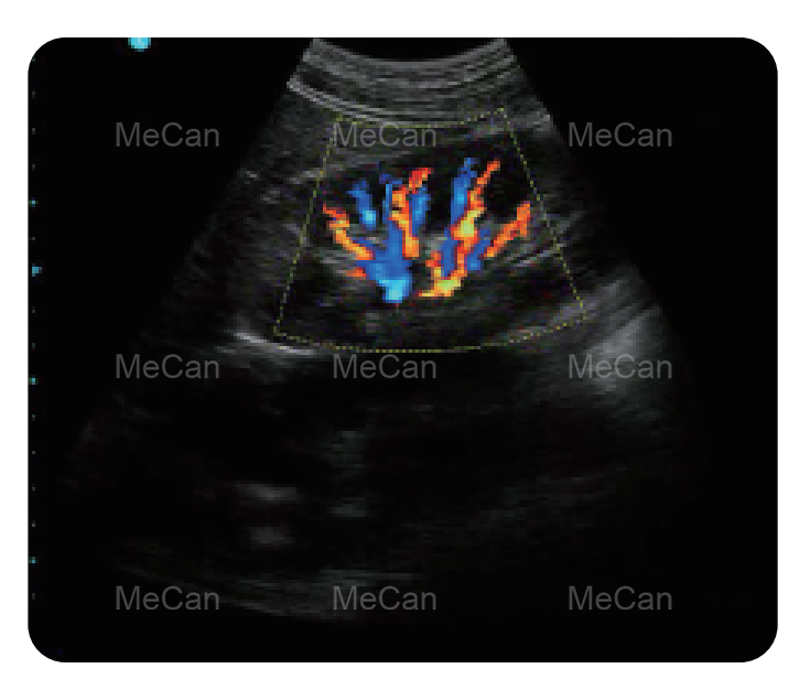 MeCan MCI0512 Portable Color Doppler Ultrasound kinerja apik banget 2