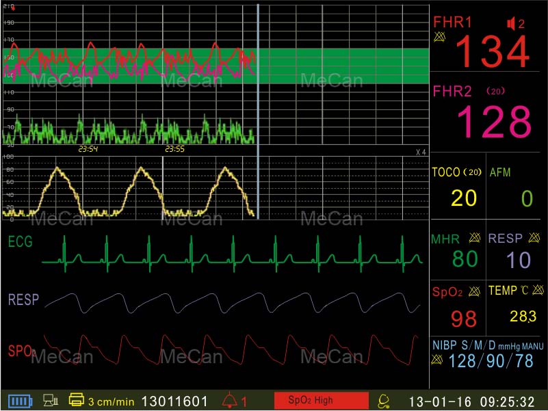 vaisiaus motinos monitorius-Motinos ir vaisiaus sąsaja