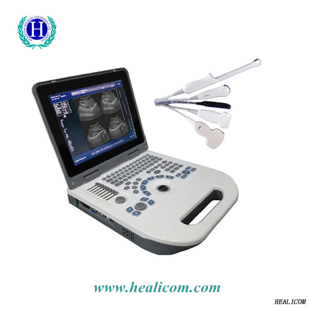 HBW-3 Plus Diagnosegerät Tragbarer Volldigitaler Tragbarer Ultraschall