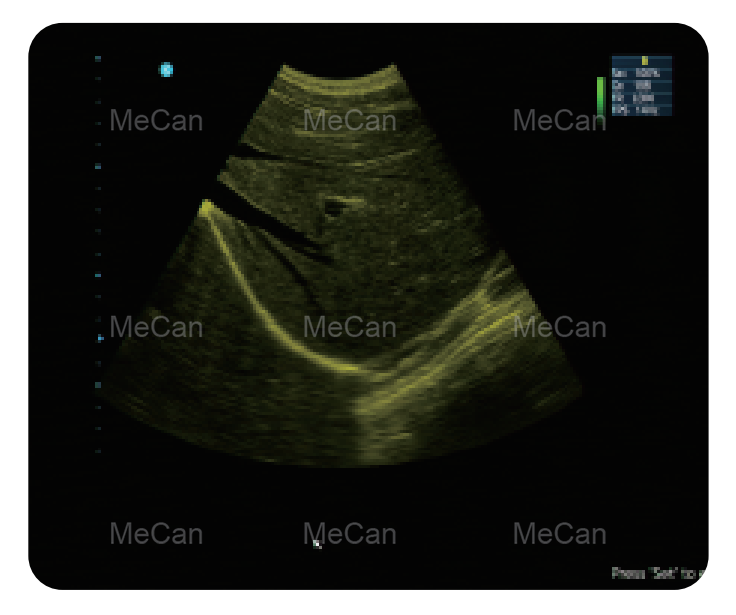 MeCan MCI0512 Portable Color Doppler Ultrasound tampilan