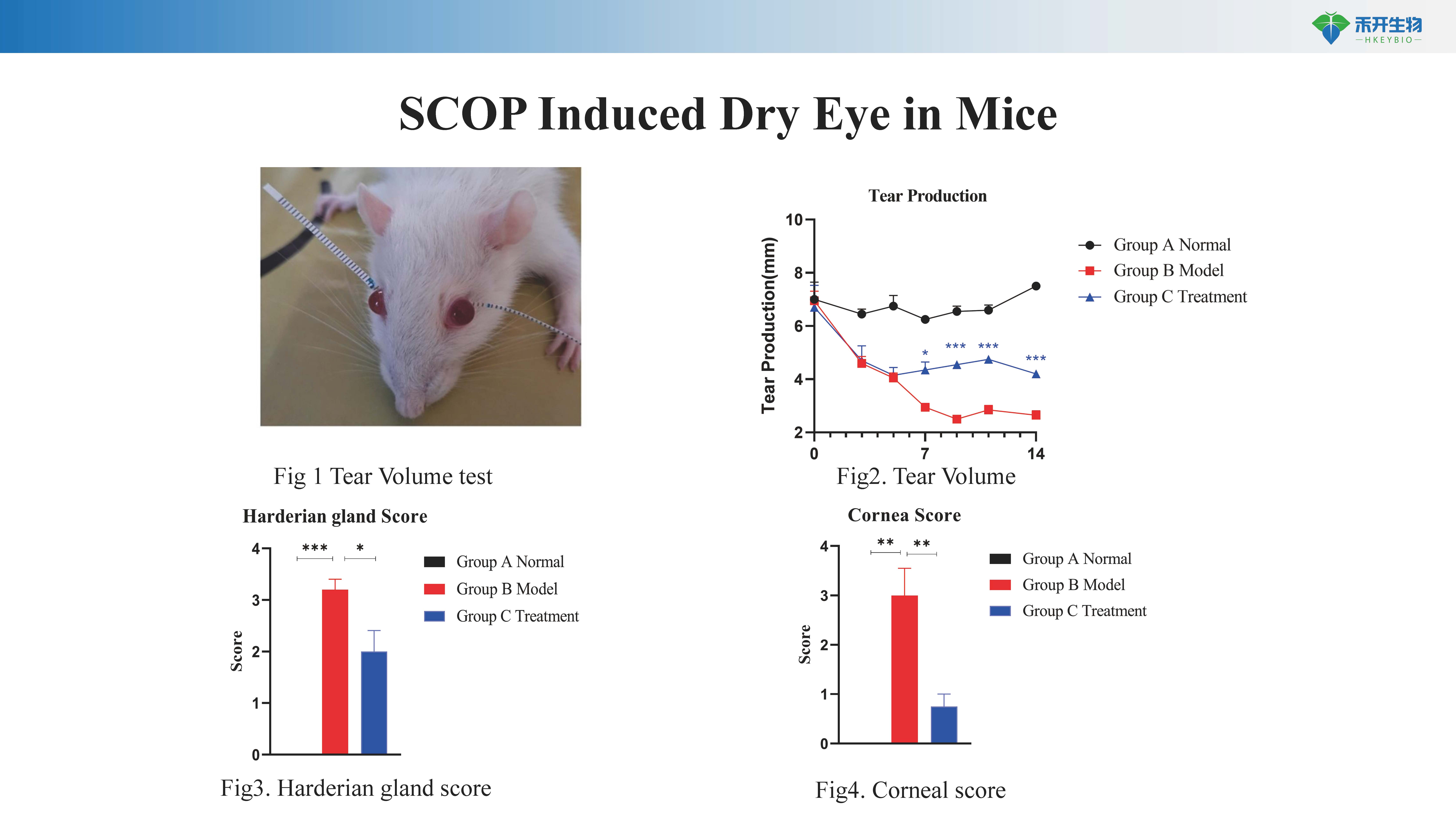 干眼症 Суво око模型介绍-20240204_20240617124237