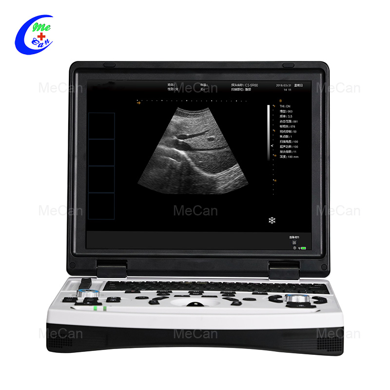 Igwe ojii na-acha ọcha na Laptọọpụ Ultrasound