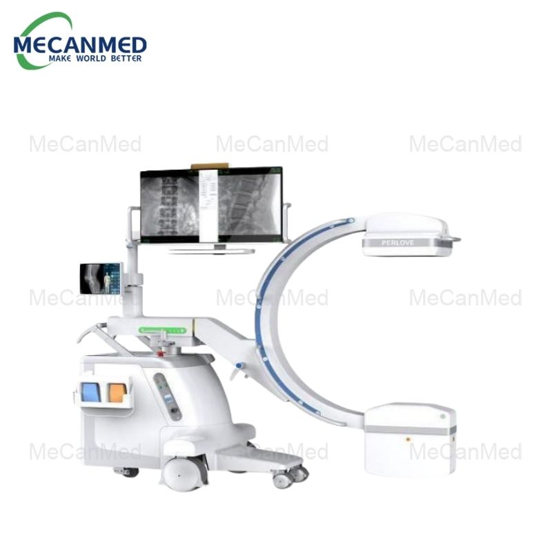 سیستم پرتو ایکس C-arm دیجیتال 5KW موبایل دیجیتال FPD (1)