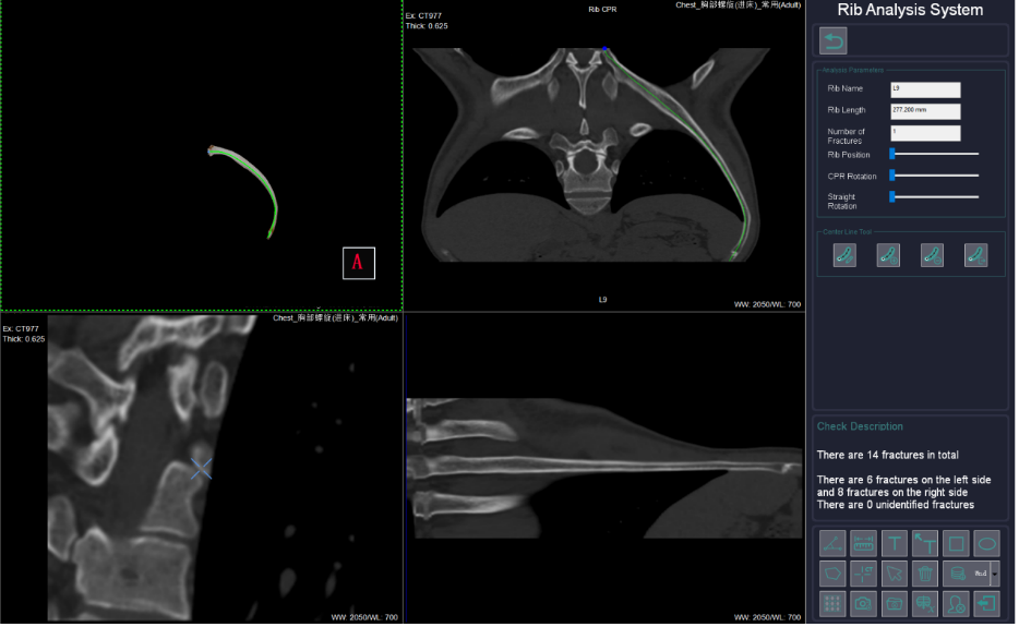 Bagaimana Mesin CT Scan Membantu dalam Perawatan Darurat dan Trauma