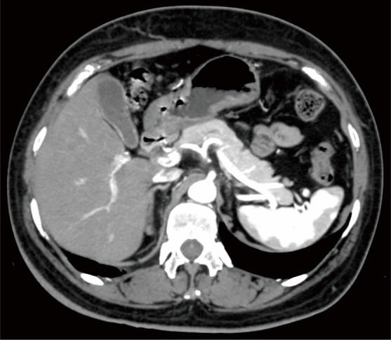 ct-scan-avanse-algorithm