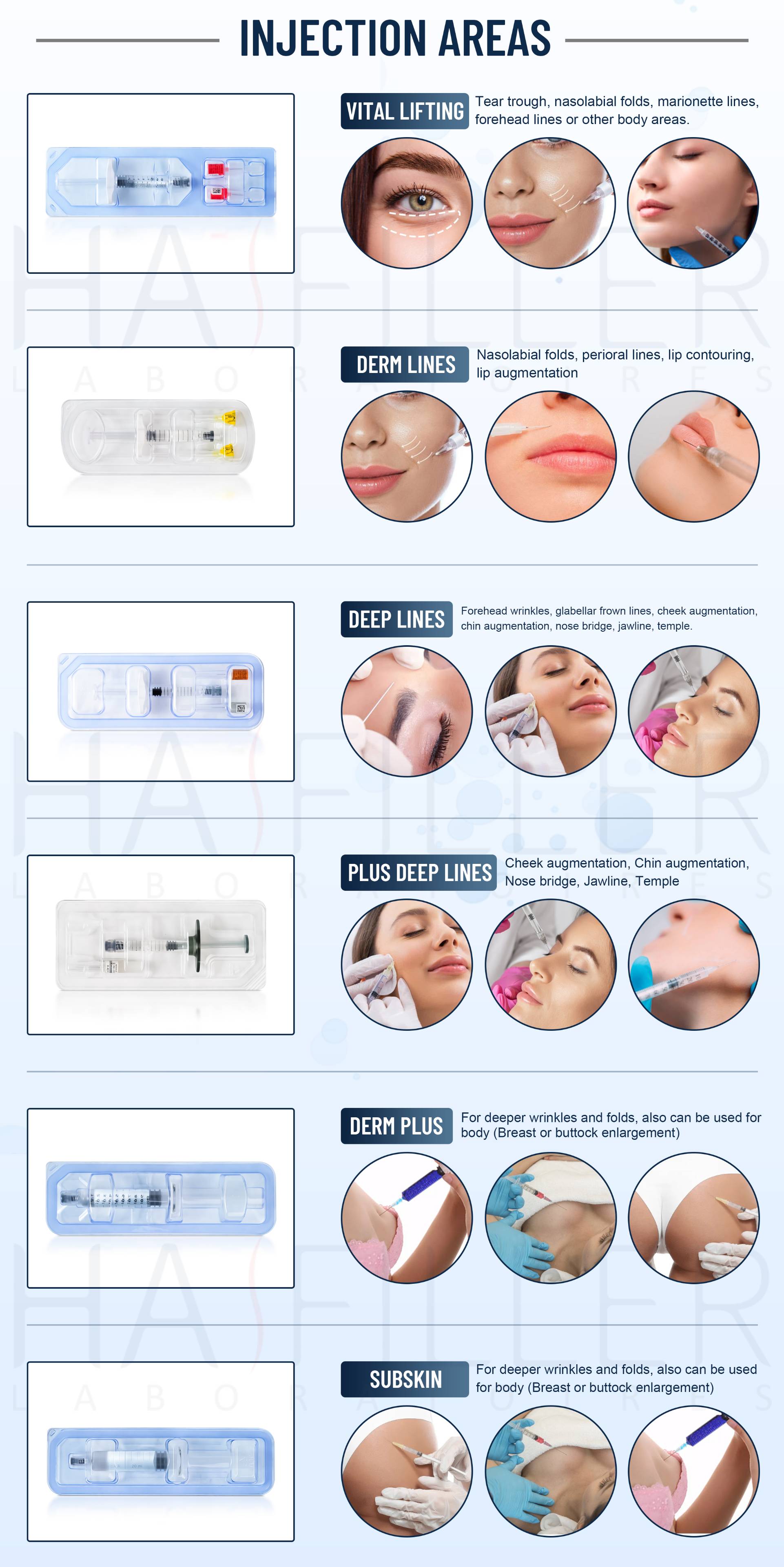 Hyaluronic एसिड भराव इंजेक्शन क्षेत्र