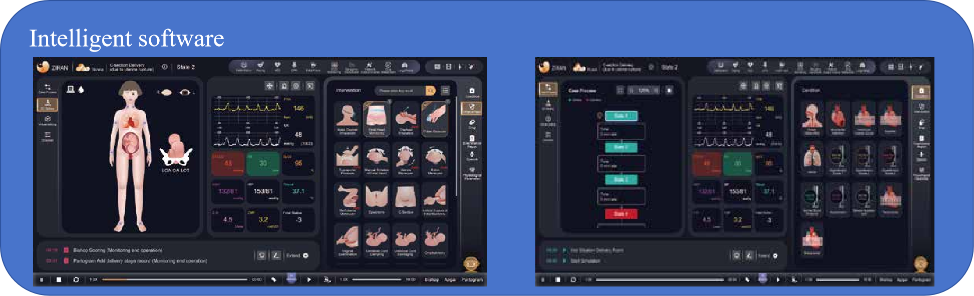 Logiciel intelligent Birth Simulator