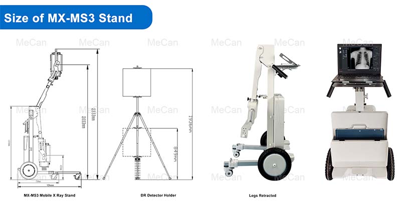 Usayizi we-x ray stand MX-MS3