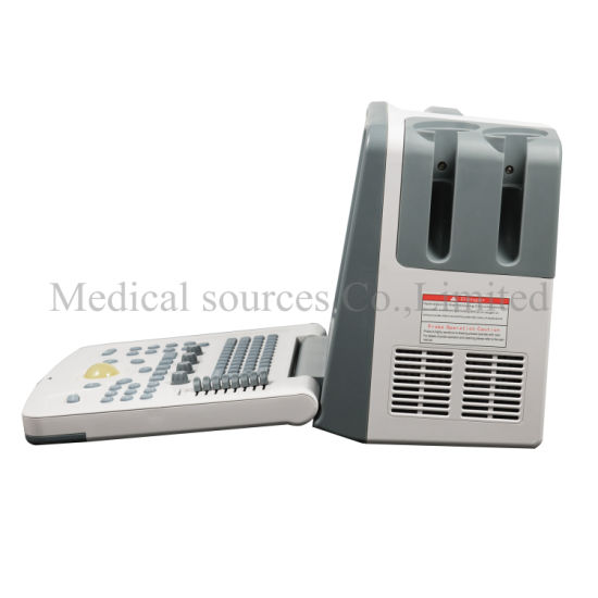 (MS-P800) Scanner à ultrasons pour ordinateur portable numérique de meilleure qualité